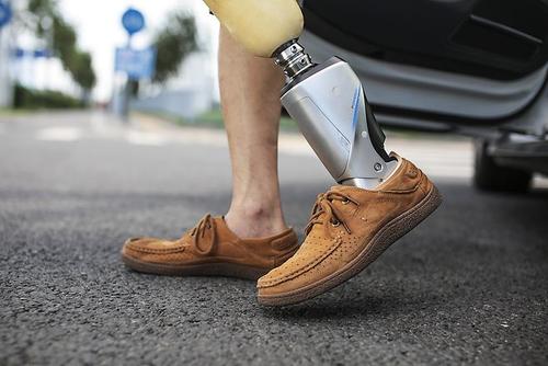 河南假肢廠家初裝假肢應該怎么樣做呢(圖1) 河南假肢廠家初裝假肢應該怎么樣做呢(圖1)