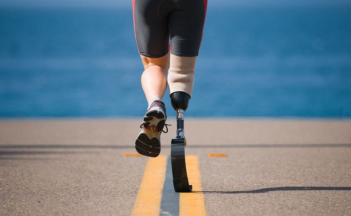 河南假肢廠家穿戴腿部假肢時這些事項(xiàng)要注意(圖1)